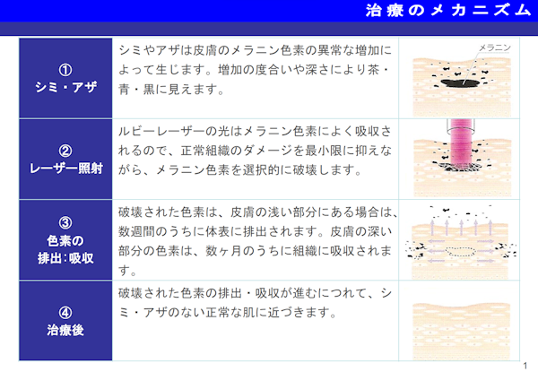 治療のメカニズム